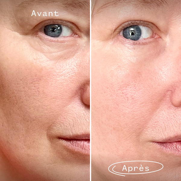Booster Rénovateur de Peau au Rétinal 0,16%